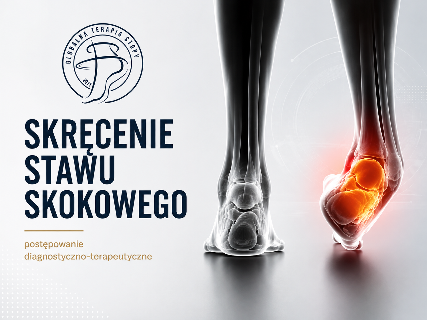 Postępowanie diagnostyczno terapeutyczne po skręceniu stawu skokowego