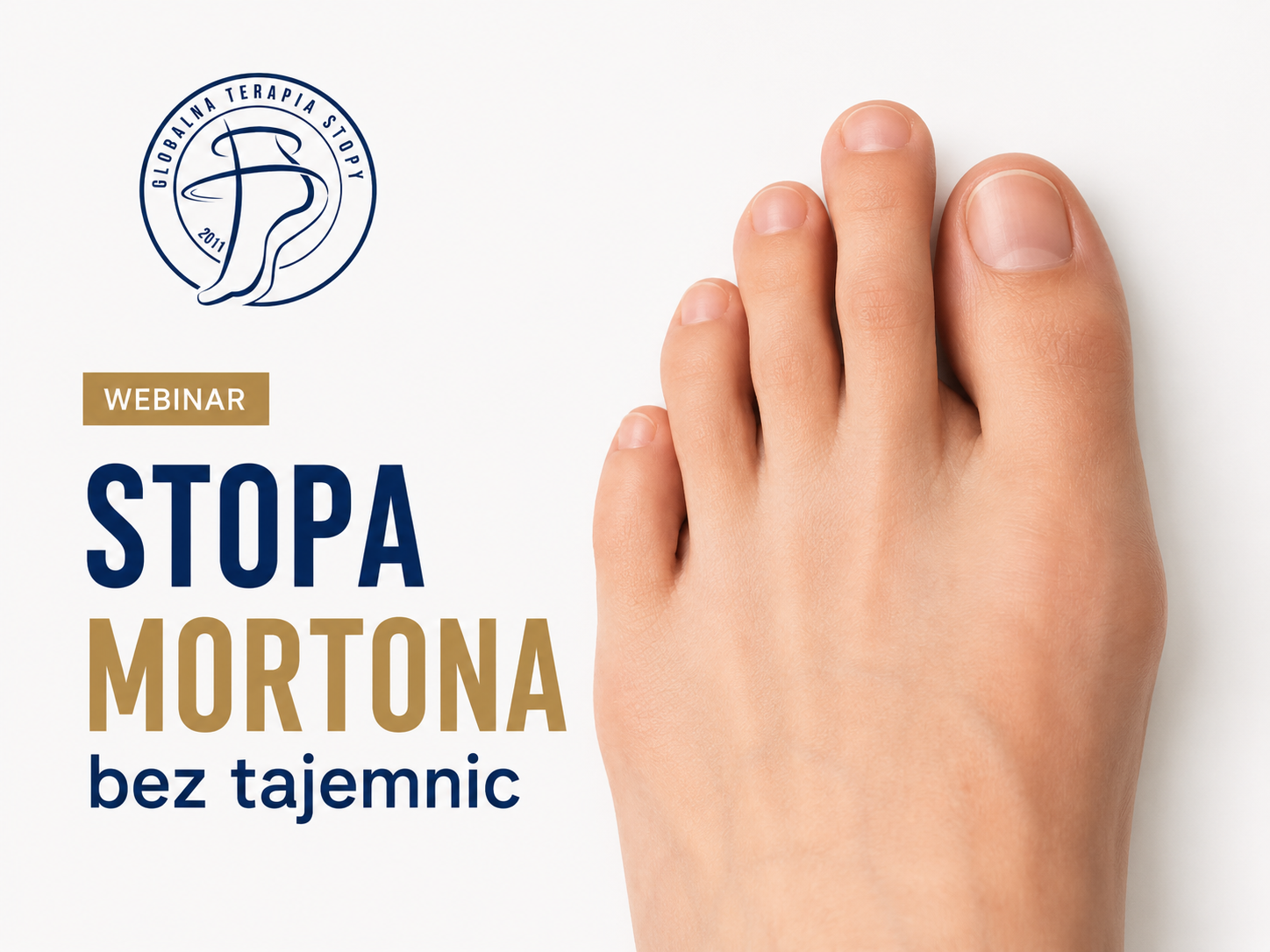 Stopa Mortona bez tajemnic
